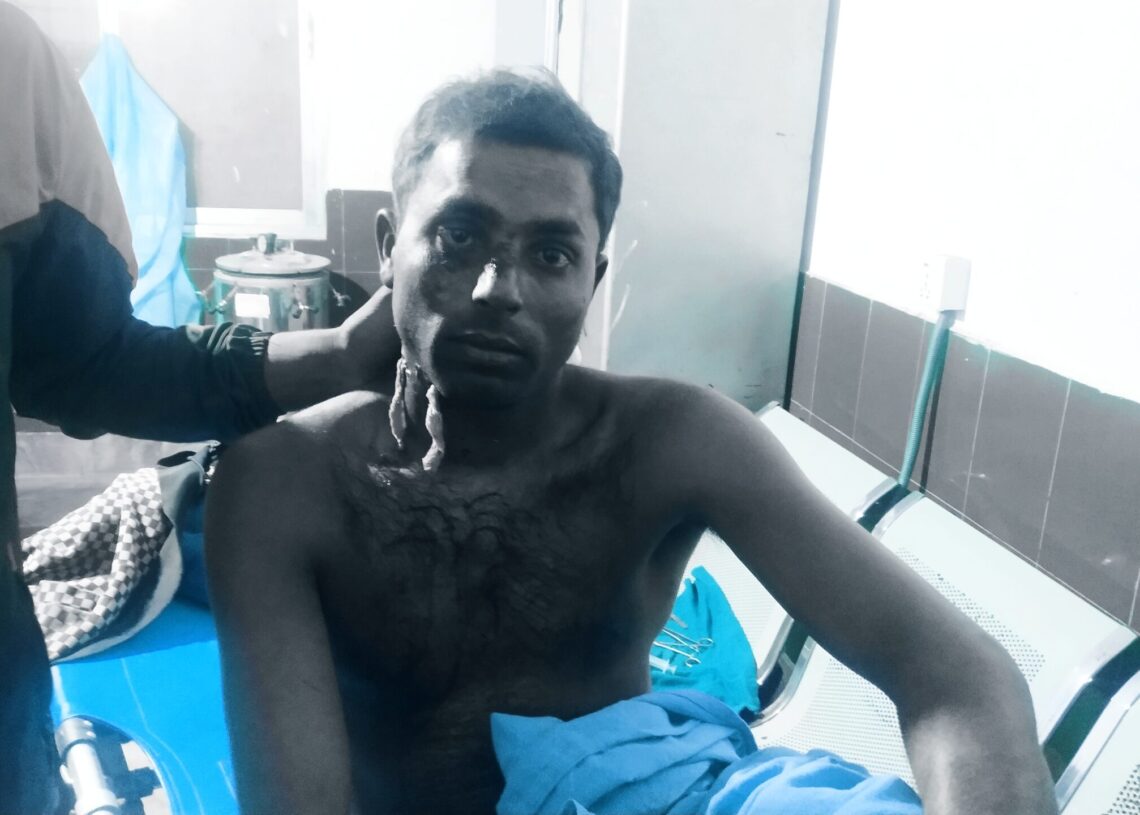बाघले फेरि राप्तीसोनारीमा मान्छेलाई आक्रमण गर्यो