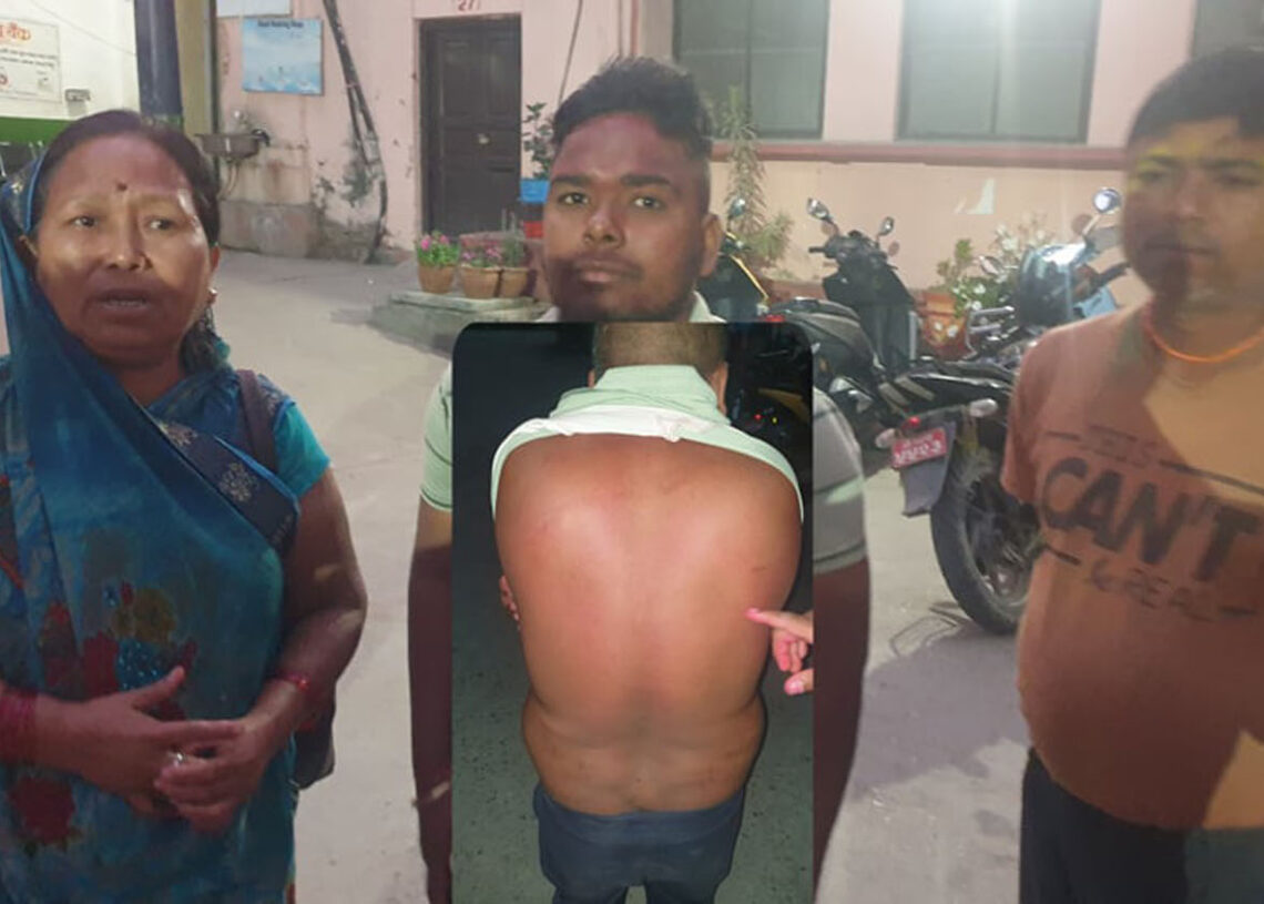 वडाअध्यक्ष गुप्ता र भाइहरुको दादागिरी, स्थानीय महिलालाई कुटे