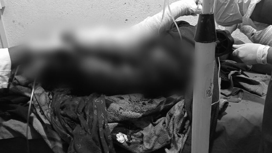 मट्टितेल छर्केर आफैँलाई जलाएकी महिलाको मृत्यु