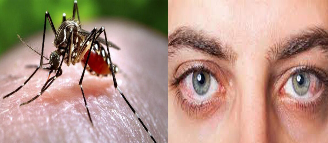 डेङ्गी र आँखा पाक्ने रोगको सङ्क्रमण देशभर फैलियो