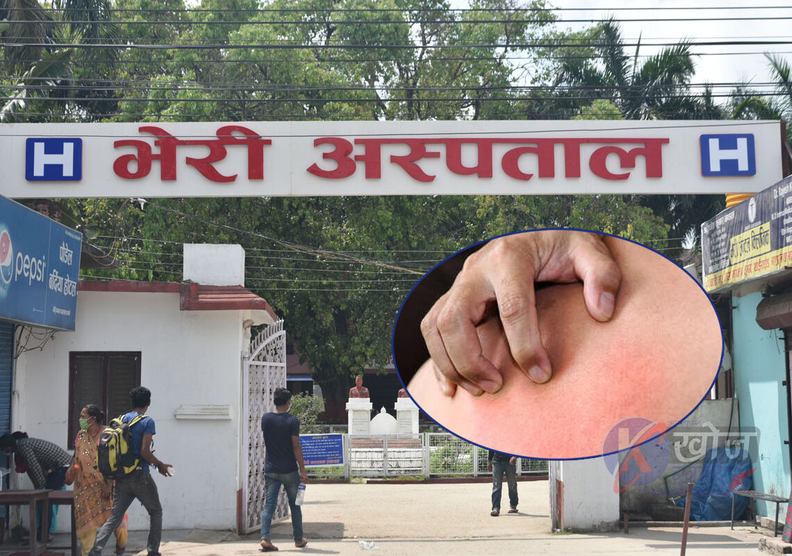 अत्यधिक गर्मीले बाँकेमा छालाका बिरामी बढे