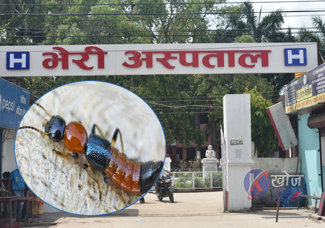 भेरी अस्पतालमा ‘नाइरोबी फ्लाई’ कीराको सङ्क्रमणका बिरामी बढ्दै